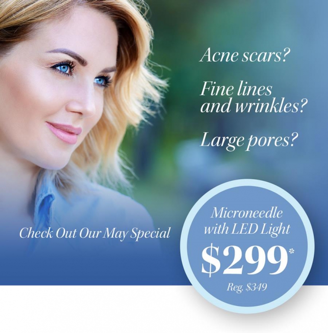 may-specials-microneedlewithLED-669x678